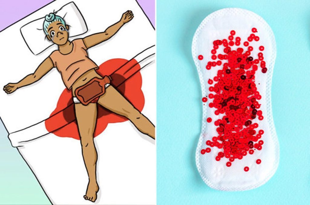 Women with endometriosis